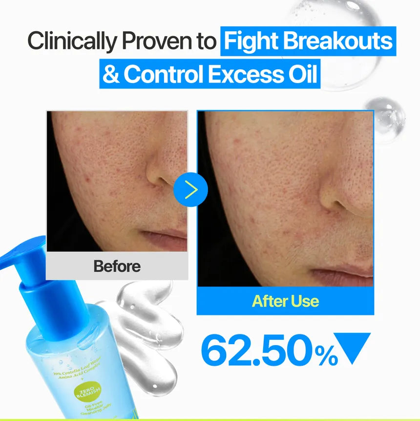 numbuzin Zero Blemish Oil-Free Micellar Cleansing Jelly