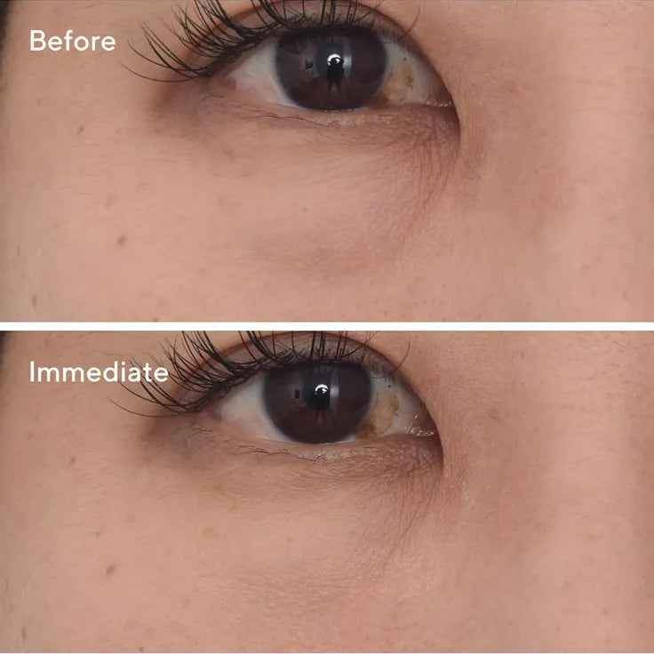 Murad Targeted Eye Depuffer