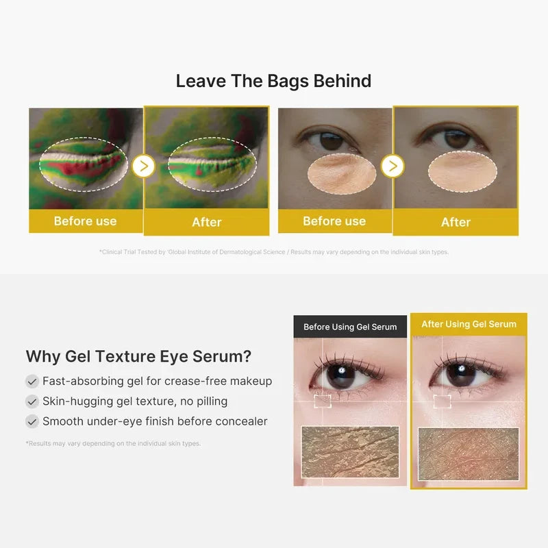 medicube Kojic Acid Turmeric Vita Eye Gel Serum