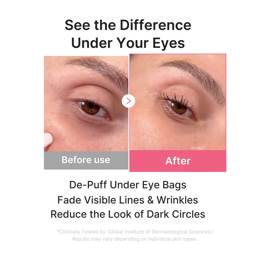 medicube PDRN Pink Collagen Jelly Eye Mask