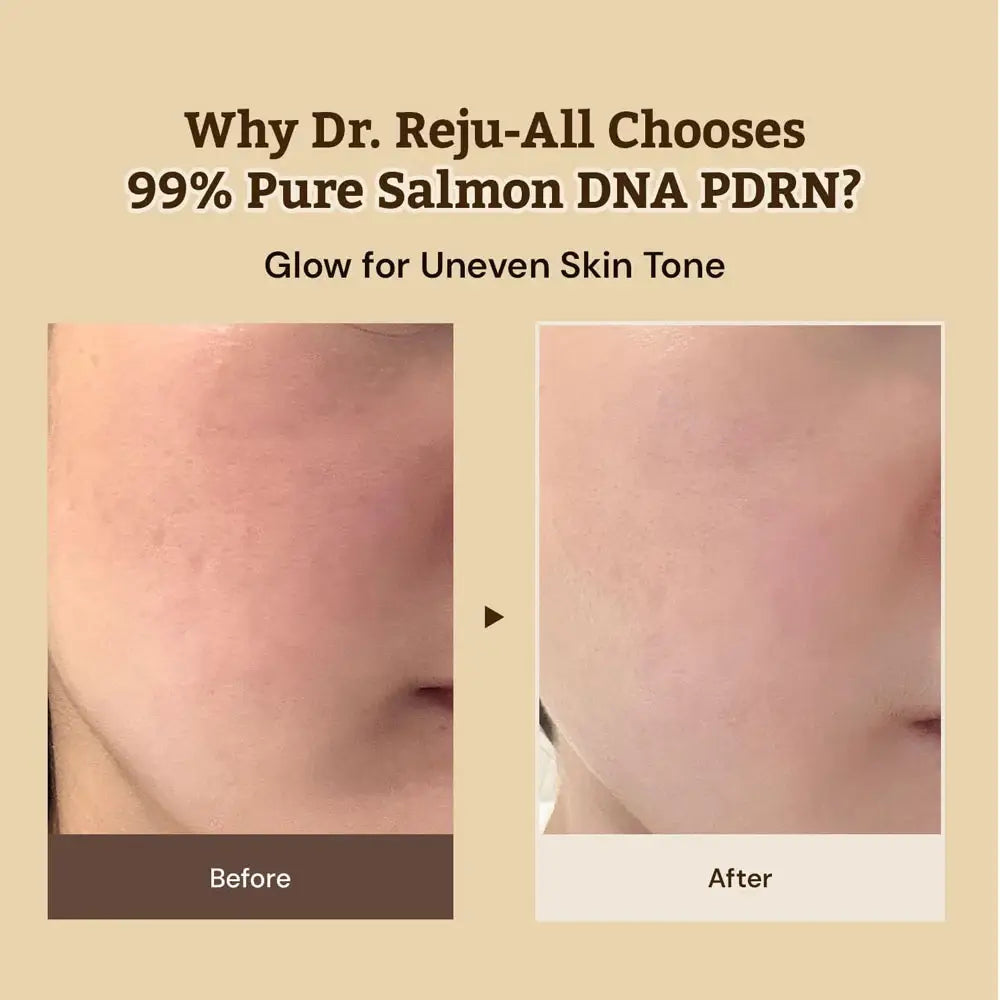 Dr. Reju-All Advanced PDRN Rejuvenating Cream