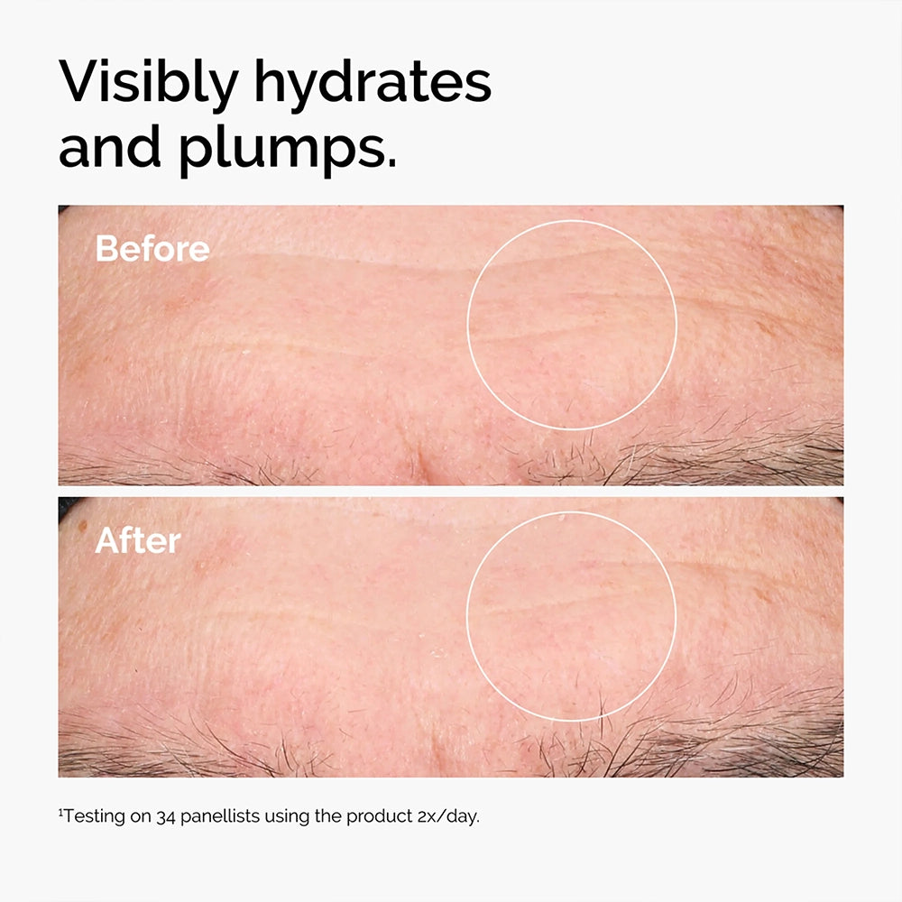 The Ordinary Hyaluronic Acid 2% + B5