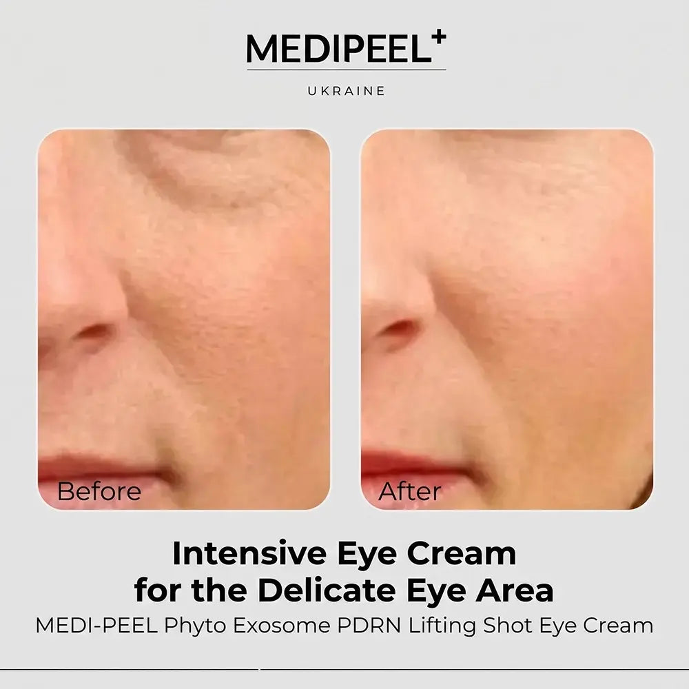 MEDIPEEL PHYTO Exosome PDRN Lifting Shot Eye Cream
