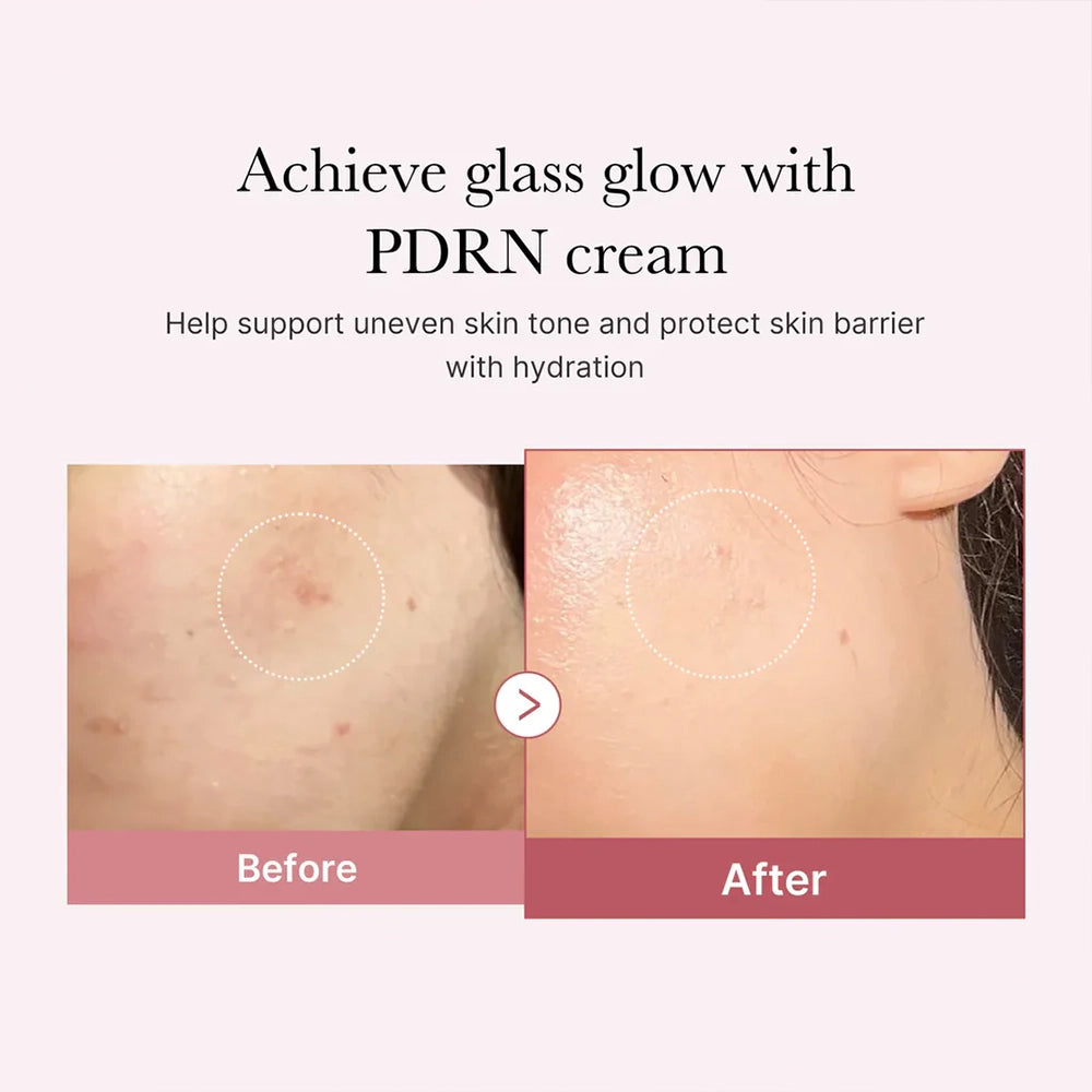 medicube - PDRN Pink Hyaluronic Moisturizing Cream