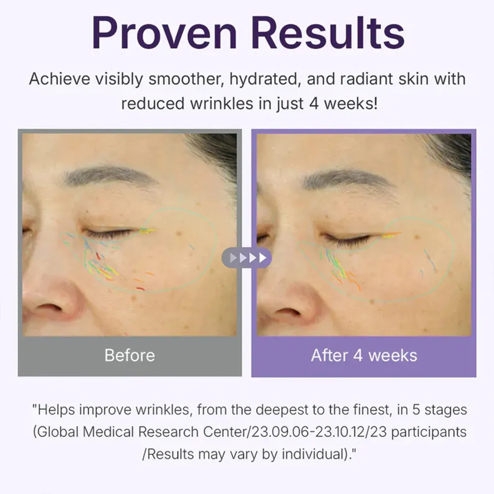 Centellian24 360º Shot PDRN Active Serum