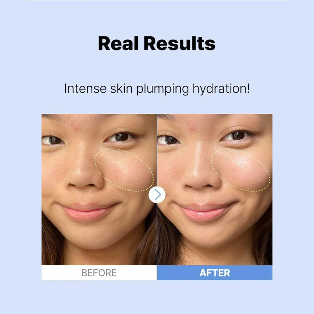 COSRX The Hyaluronic Acid 3 Serum