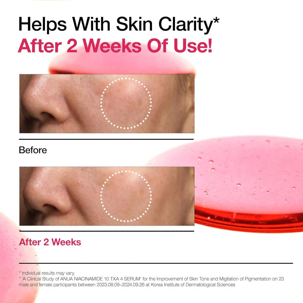 Anua Niacinamide 10% + TXA 4% Serum