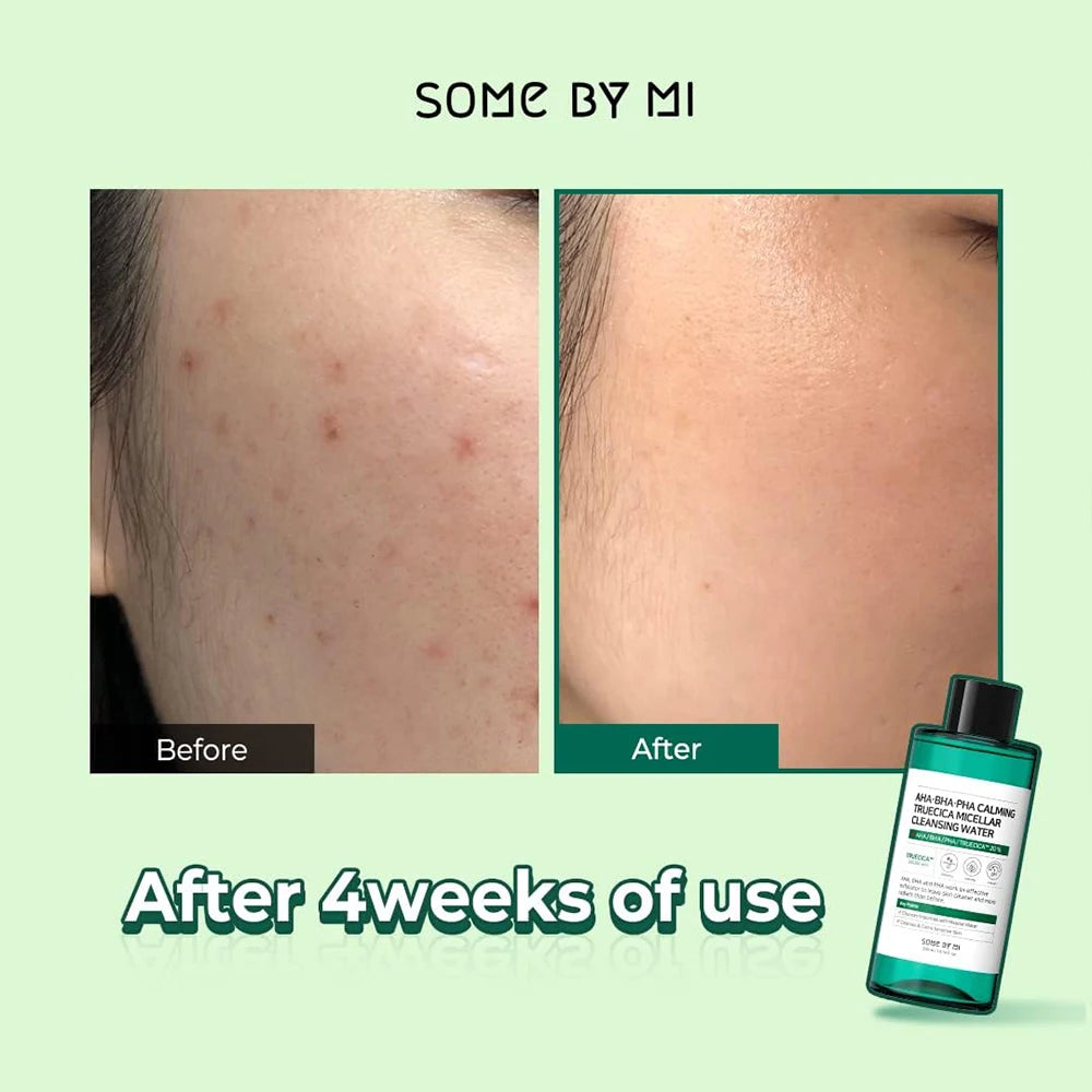 SOME BY MI AHA-BHA-PHA Calming Truecica Micellar Cleansing Water