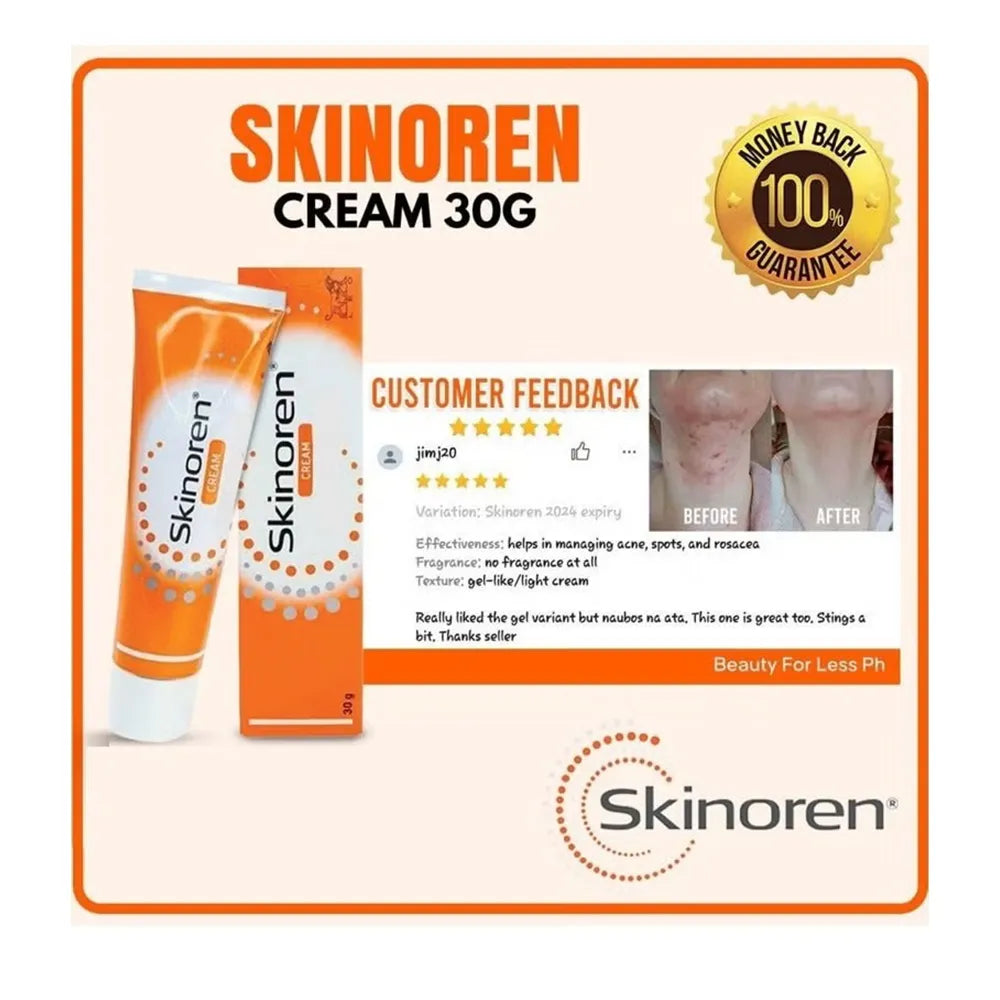 Skinoren Cream 20% Azelaic Acid