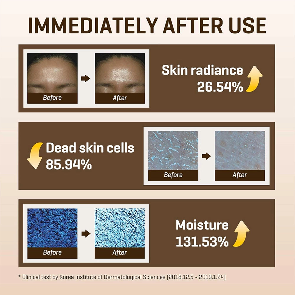 SOME BY MI Galactomyces Pure Vitamin C Glow Toner