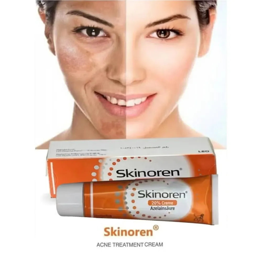 Skinoren Cream 20% Azelaic Acid
