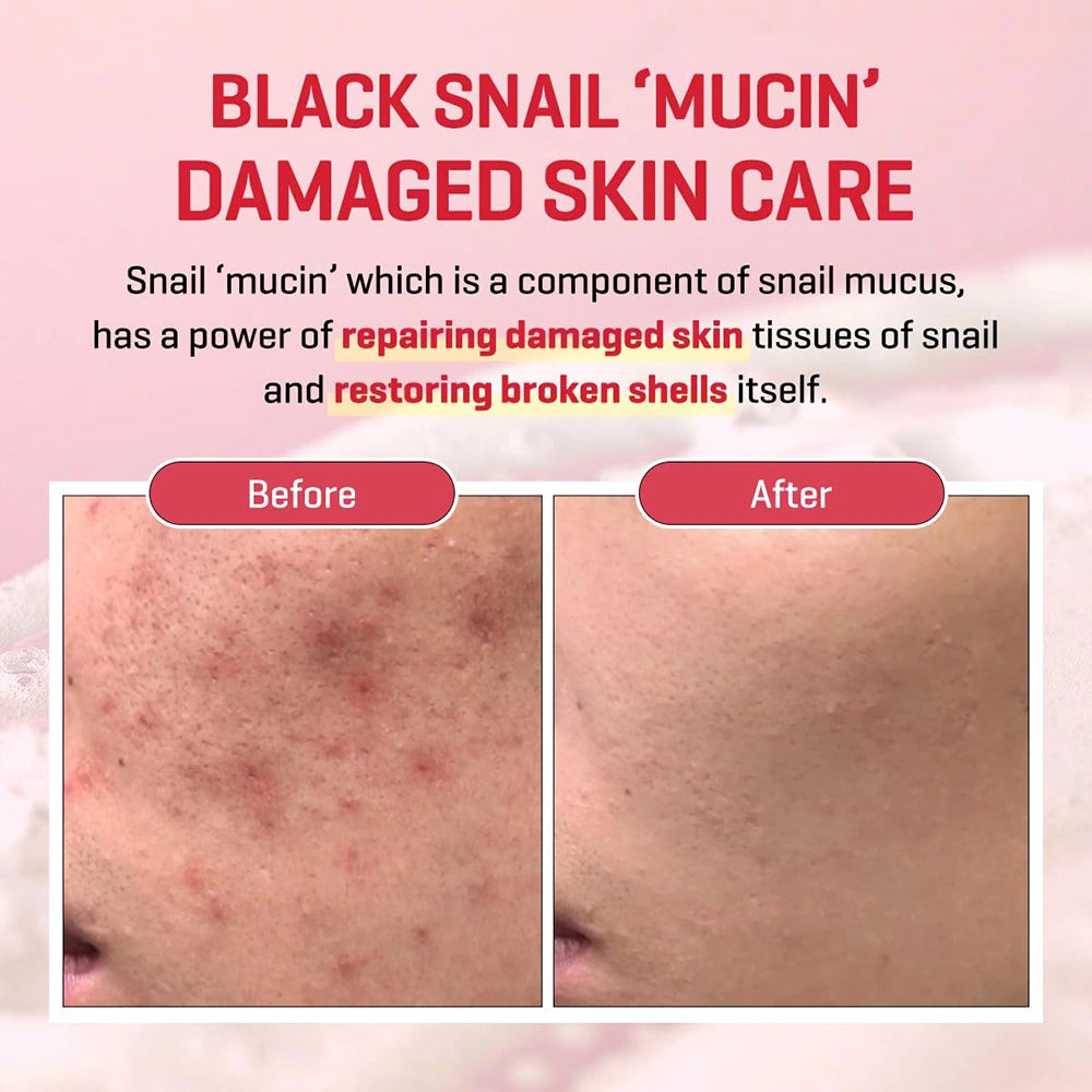 SOME BY MI Snail Truecica Miracle Repair Serum