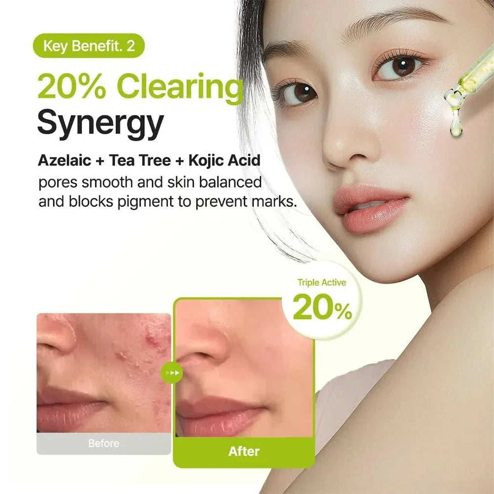 Purito SEOUL Azelaic Acid 10% + Kojic Acid + Tea Tree Facial Serum