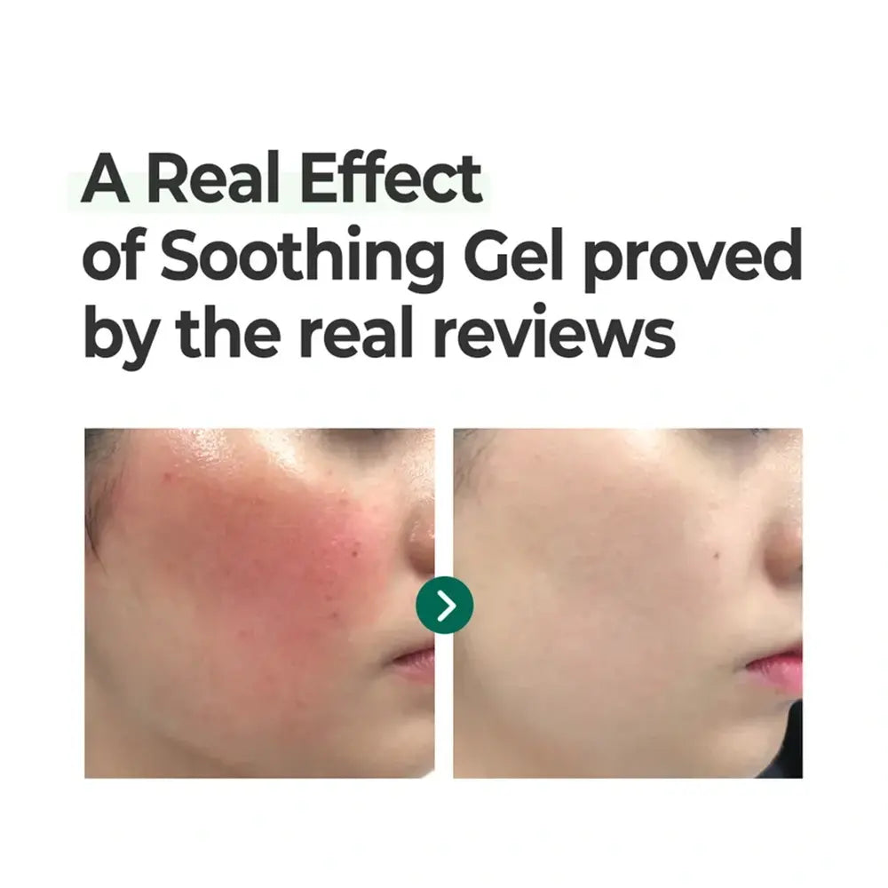 SOME BY MI AHA-BHA-PHA Real Cica 92% Cool Calming Soothing Gel