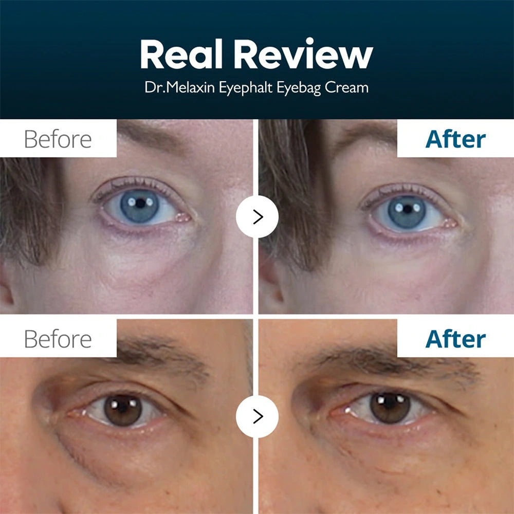 Dr.Melaxin  Eyephalt Eyecream for Eyebags