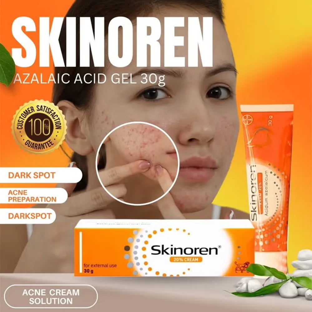 Skinoren Cream 20% Azelaic Acid
