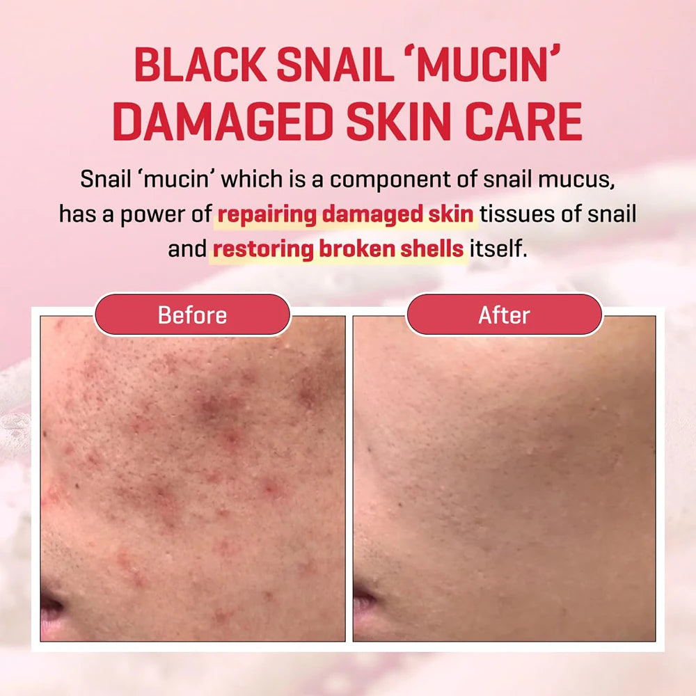 SOME BY MI Snail Truecica Miracle Repair Cleansing Gel