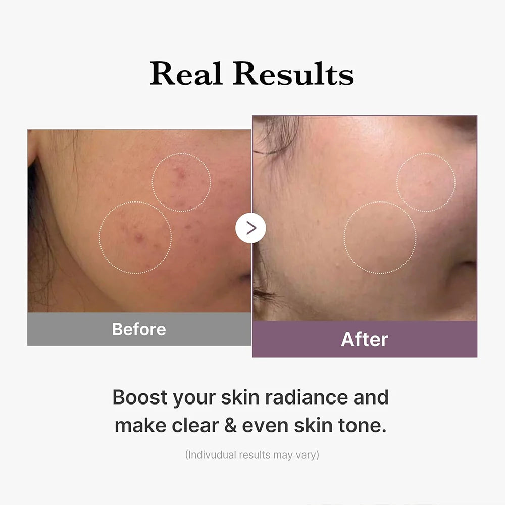 medicube Age-R Glutathione Glow Toner