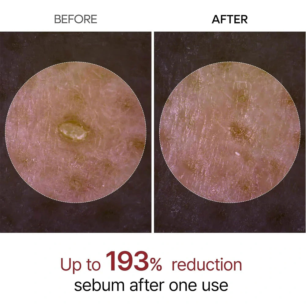 Dr.Melaxin Peel Shot Exfoliating Black Rice Ampoule