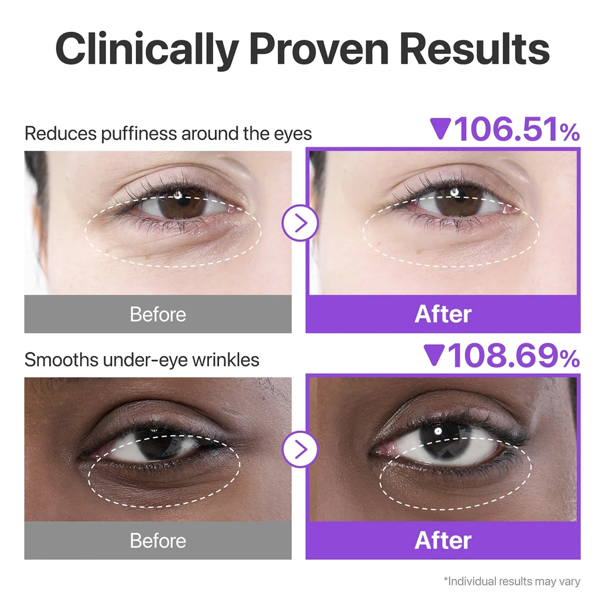 numbuzin 9+ NAD+ Collagen Under Eye Patches
